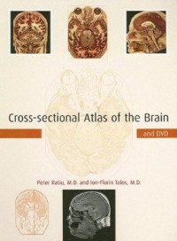 Cross-sectional atlas of the brain