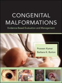 Congenital malformations